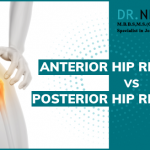 anterior hip replacement vs posterior hip replacement | Dr Niraj Vora ...
