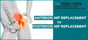 anterior hip replacement vs posterior hip replacement