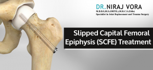 Slipped Capital Femoral Epiphysis (SCFE) Treatment | Dr Niraj Vora