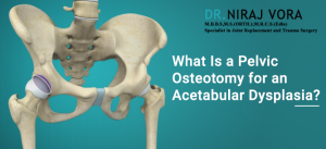 What Is a Pelvic Osteotomy for an Acetabular Dysplasia | Dr Niraj Vora