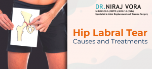 Hip Labral Tear Symptoms Causes and Treatments | Dr Niraj Vora