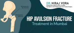 Hip Avulsion Fracture Treatment in Mumbai | Dr Niraj Vora