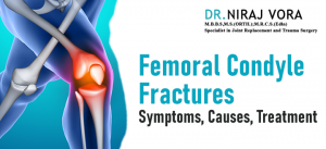 Femoral Condyle Fractures: Symptoms Causes and Treatment | Dr Niraj Vora